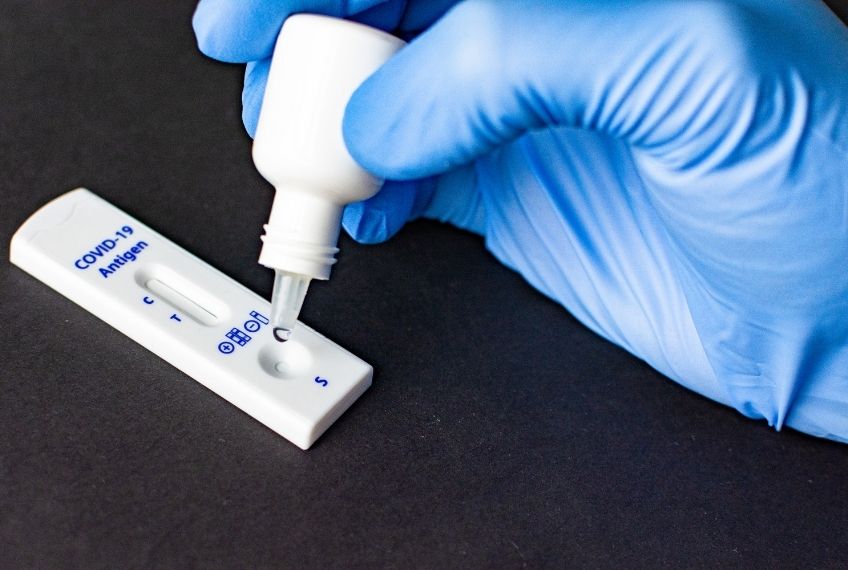 צריכים בדיקת קורונה? עם AIDG תוכלו לבצע בדיקות אנטיגן ו-PCR!